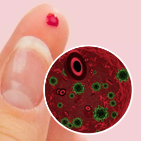 Гемосканирование крови на паразитов